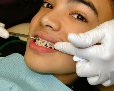 Kids Okaloosa County, Walton County and Bay County: Orthodontists - Fun 4 Emerald Coast Kids
